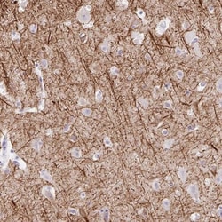 TMEM85 Antibody, Novus Biologicals:Antibodies:Primary Antibodies